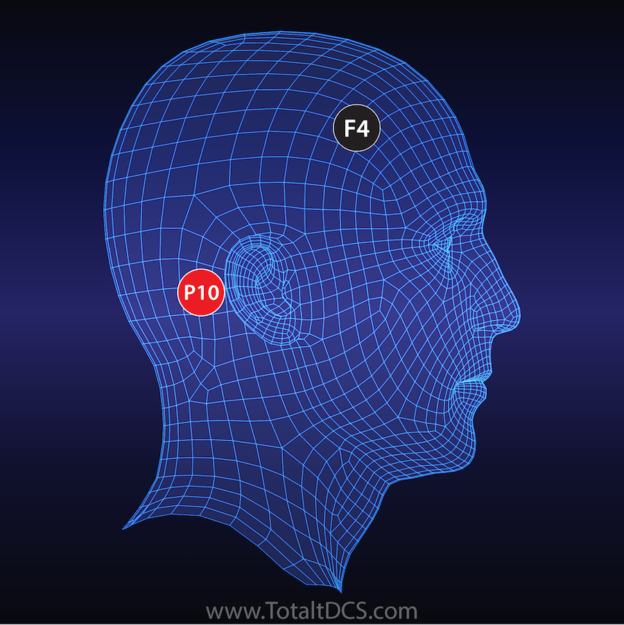 tDCS Placements - Increased Present Awareness - P10_F4